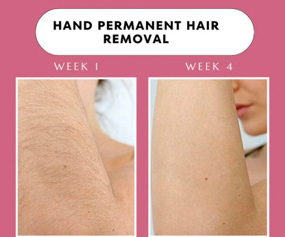 Elitezza IPL Pro - Laser Hair Removal Device