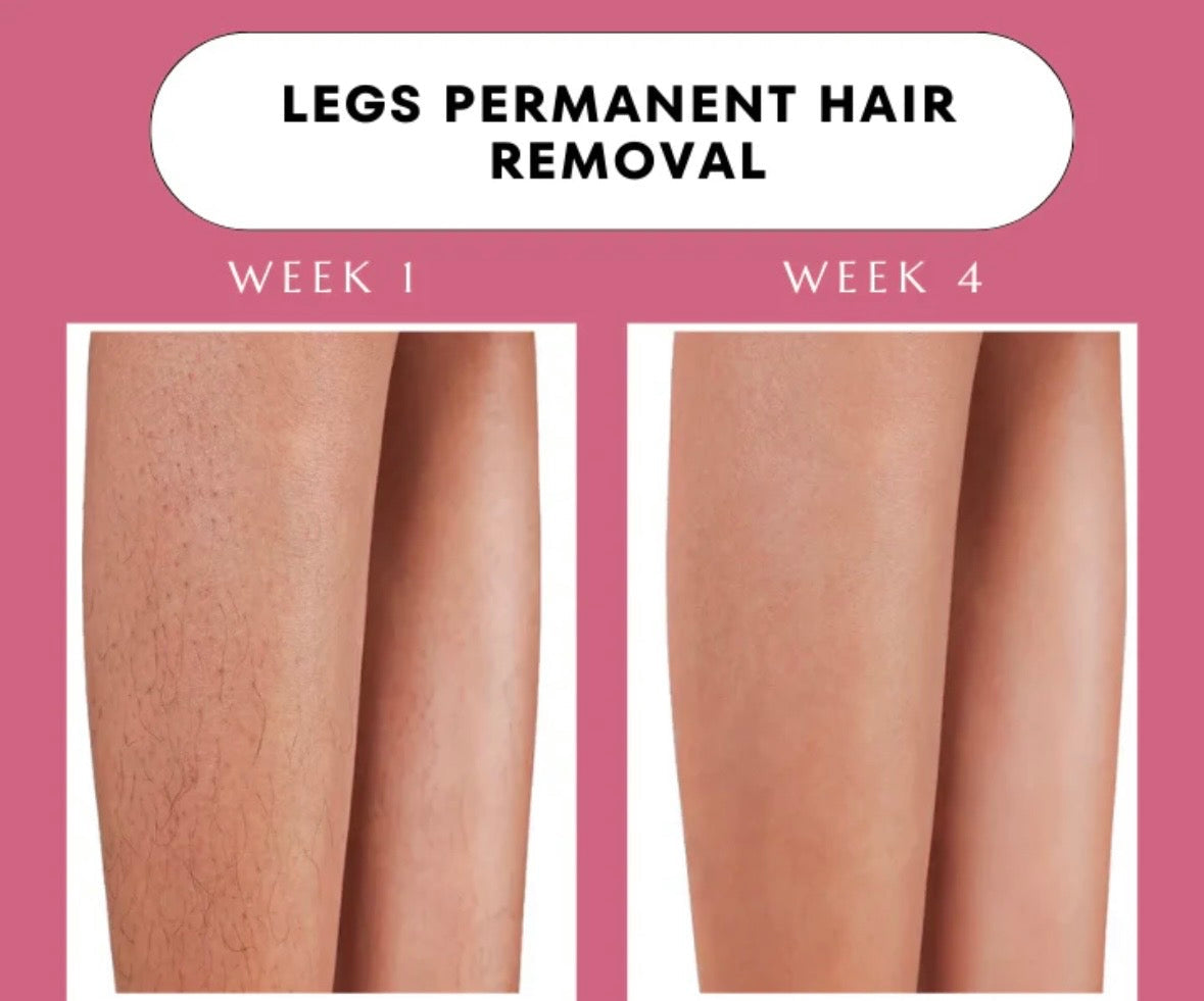 Elitezza IPL Pro - Laser Hair Removal Device