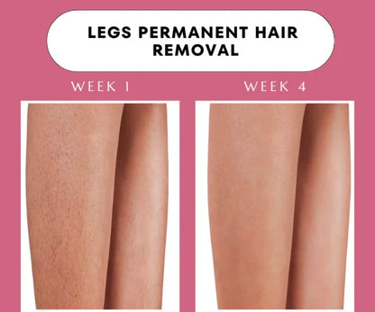 Elitezza IPL Pro - Laser Hair Removal Device